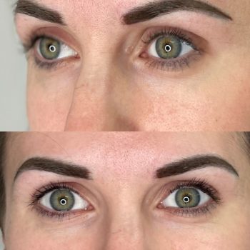 Andy eyebrows post 6-25-25