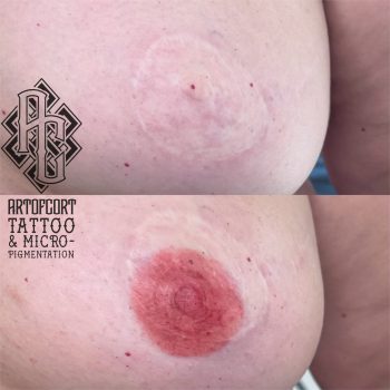 Areola training 10-10-23