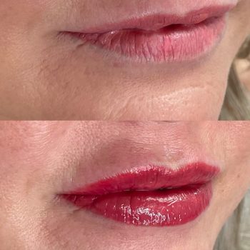 Ashley Lips post 6-6-25