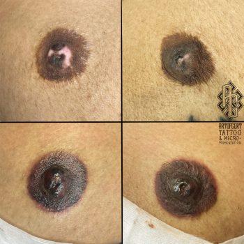 Shica S areola post 10-6-23 2